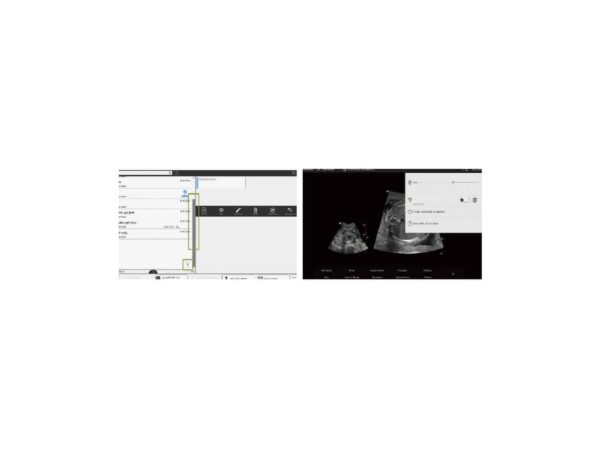Echographe Vinno A3 + Convexe + Linéaire – Image 5