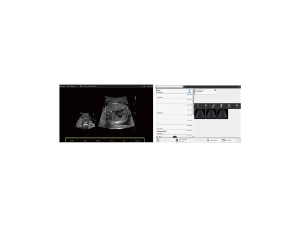 Echographe Vinno A3 + Convexe + Linéaire – Image 6