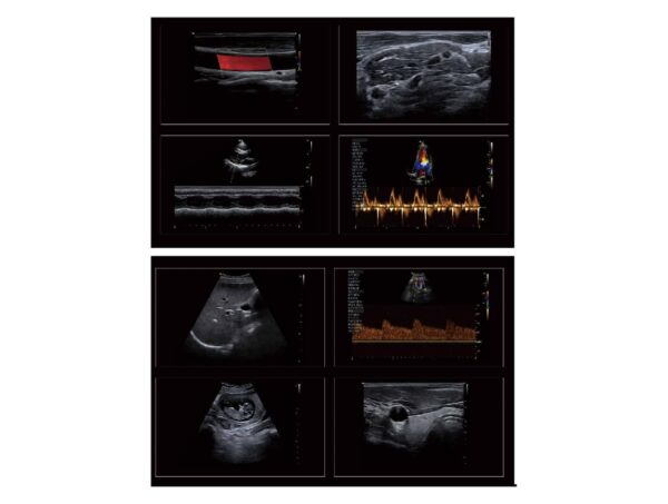 Echographe Vinno A3 + Convexe + Linéaire – Image 7