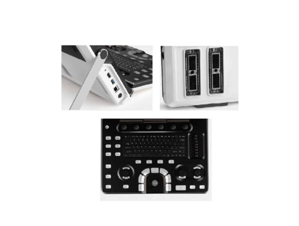 Echographe Vinno A3 + Convexe + Linéaire – Image 4