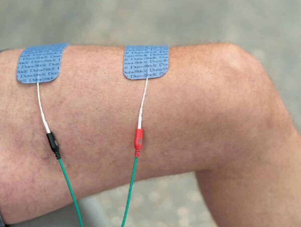 Electrostimulateur Stim Intelect Mobile 2 – Image 3