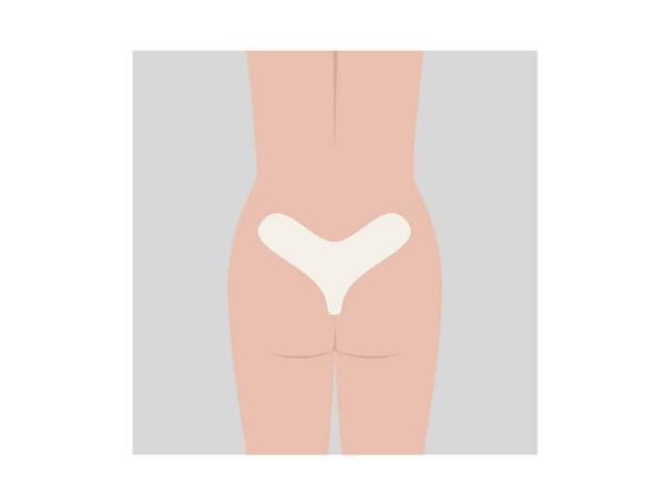 Plaque forme sacrum pour la répartition de la pression – Image 3