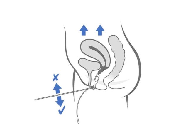 Sonde vaginale universelle Periform – Image 5