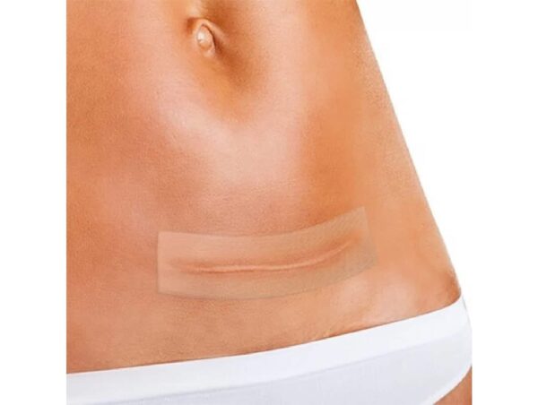 Plaque de silicone